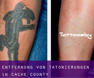 Entfernung von Tätowierungen in Cache County