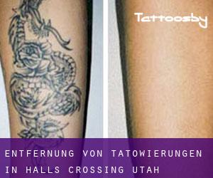 Entfernung von Tätowierungen in Halls Crossing (Utah)