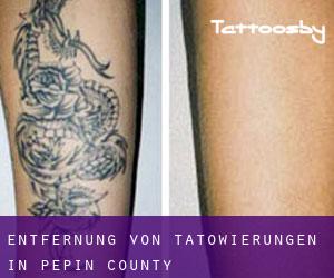 Entfernung von Tätowierungen in Pepin County